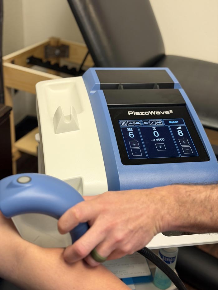 Extracorporeal Shockwave Therapy